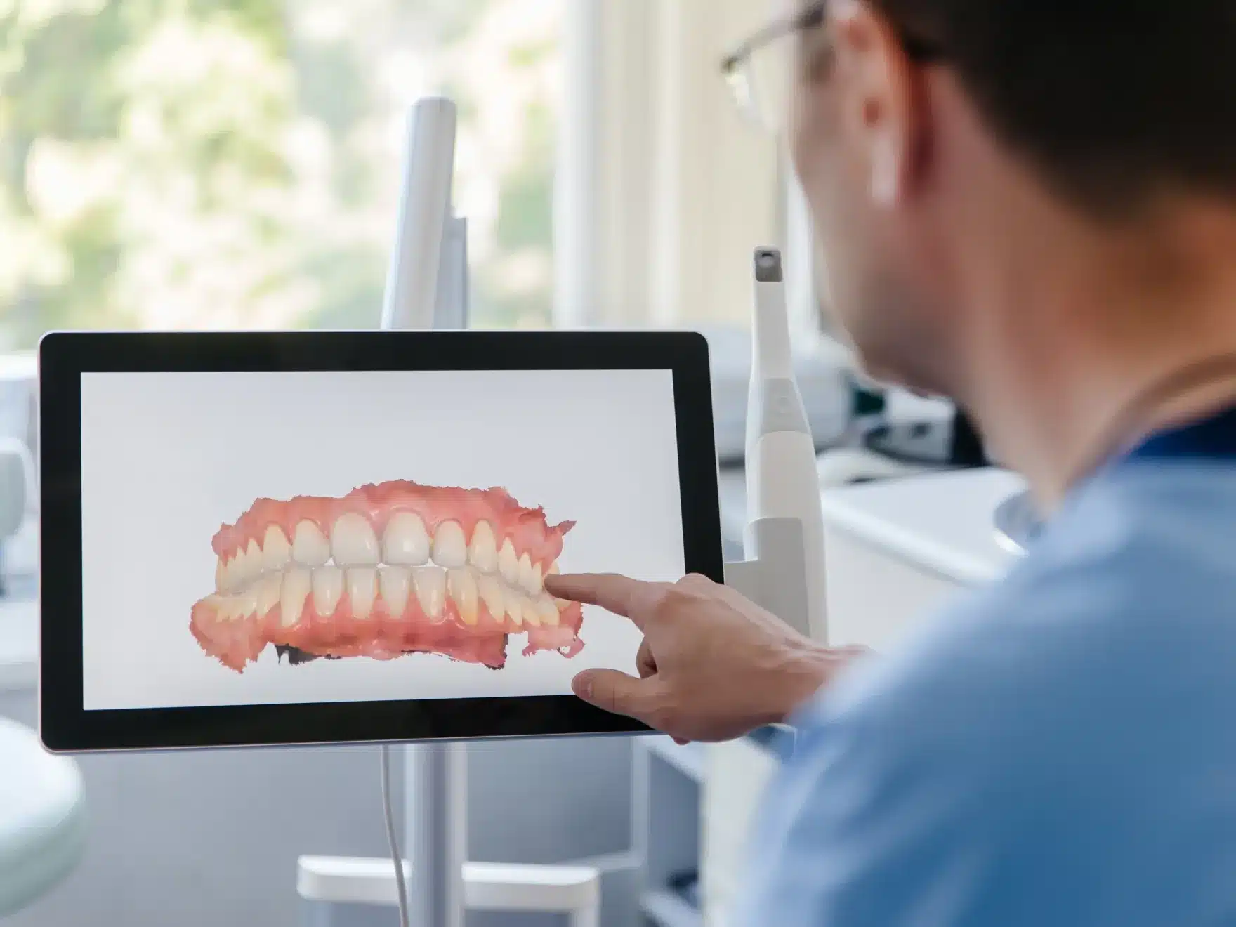 Male dentist’s hand pointing at a computer screen displaying a 3D intraoral scan